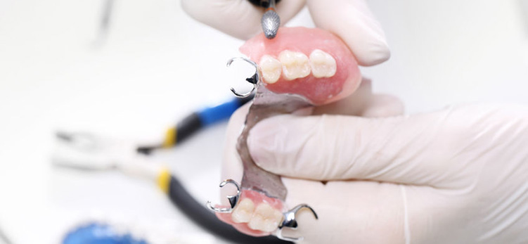 Partial-Dentures_burnside-dental-centre